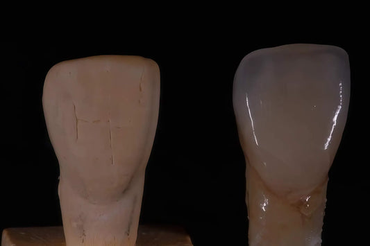 UT zirconia block for esthetic anterior crowns and veneers