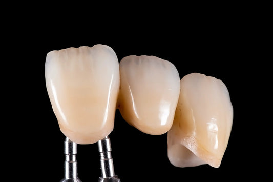 Gradient layered zirconia block for esthetic restorations