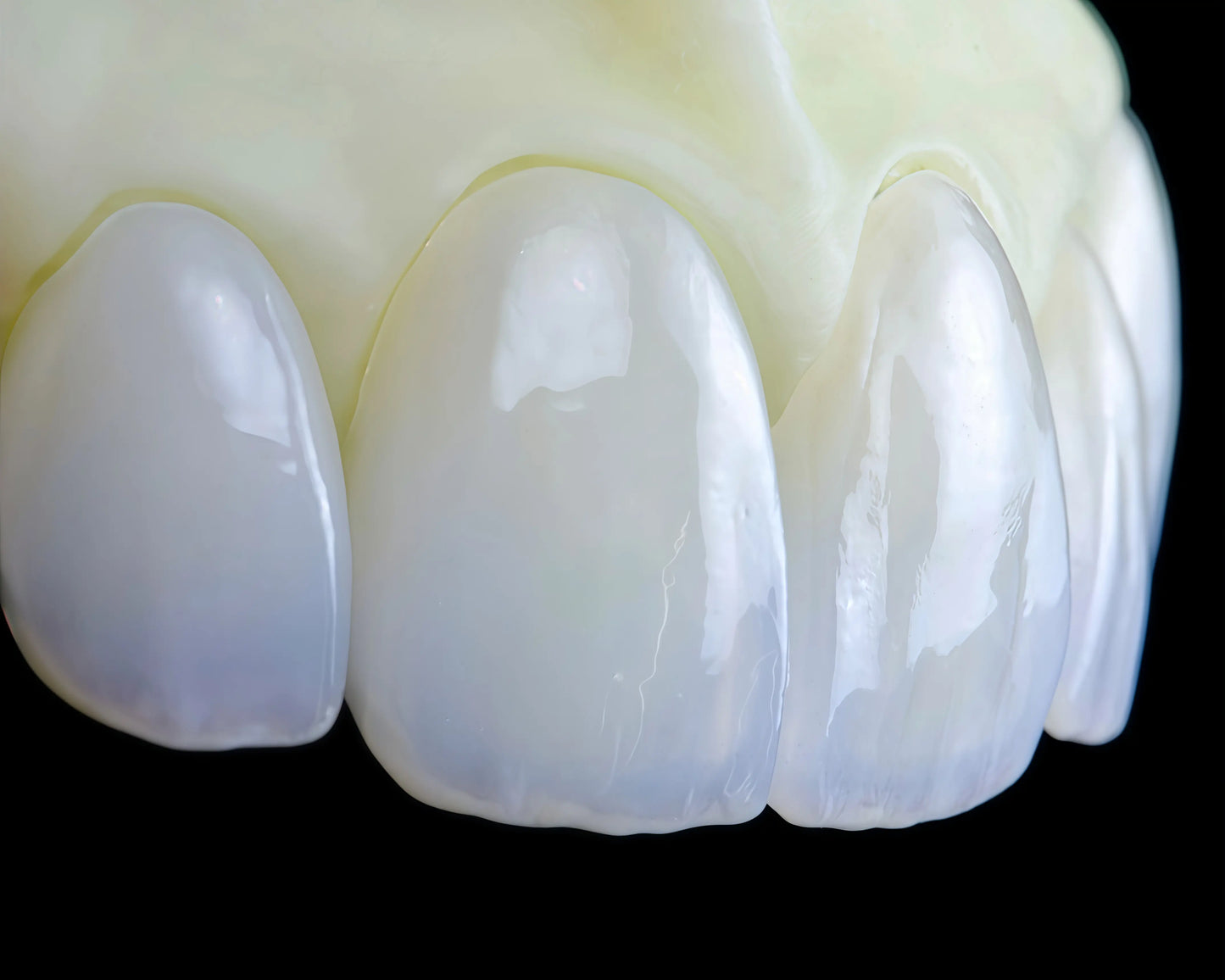 Lithium disilicate ingot designed for aesthetic dental restorations