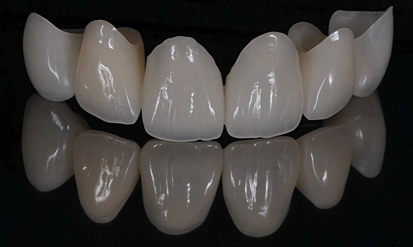 Gradient shade PMMA dental disc for superior aesthetic performance