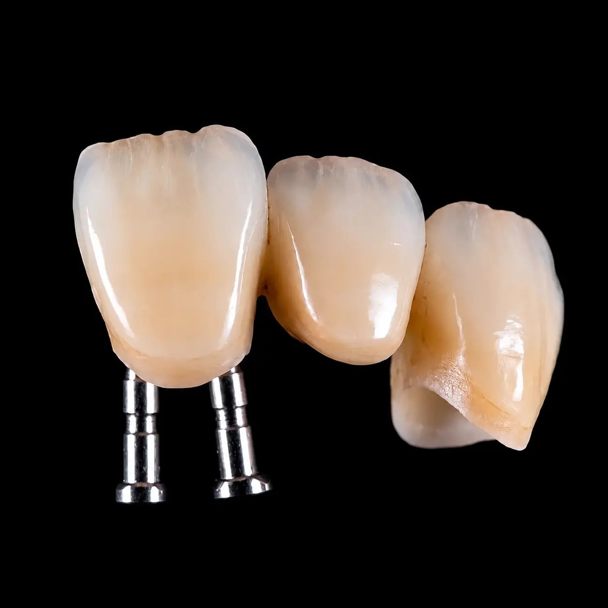 SHT Multilayer zirconia esthetic crown restorations with natural shade transition for dental lab applications