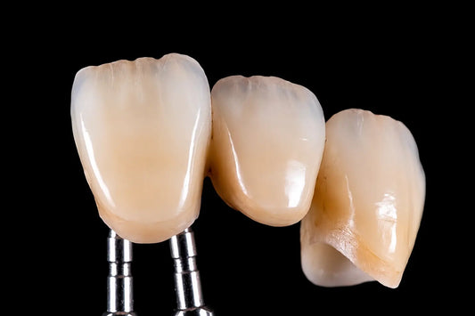 SHT Multilayer zirconia esthetic crown restorations with natural shade transition for dental lab applications