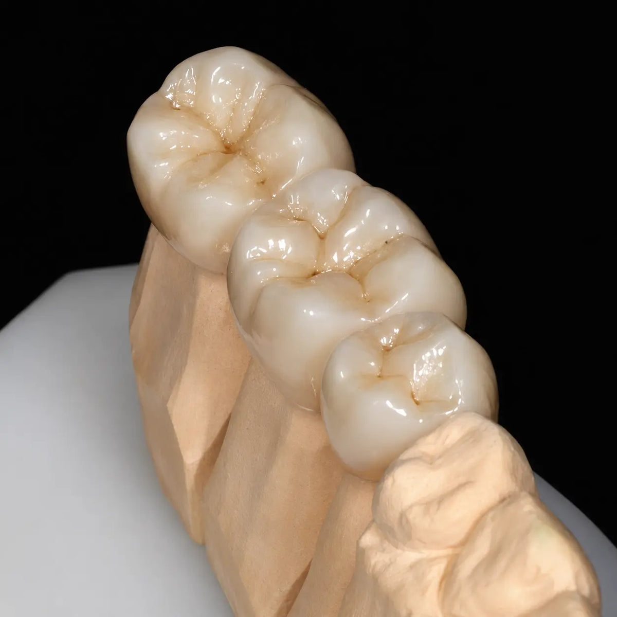 ST White zirconia crown restoration on dental model for natural posterior dental lab cases