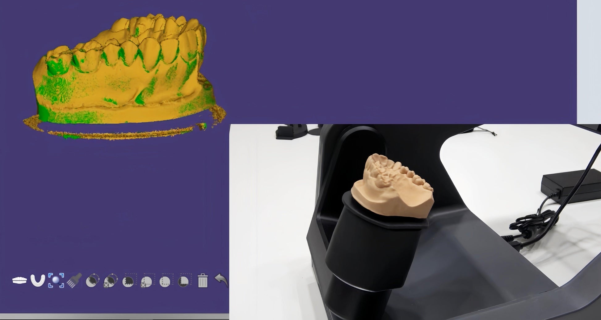 State-of-the-art dental scanner for enhanced prosthetic design accuracy