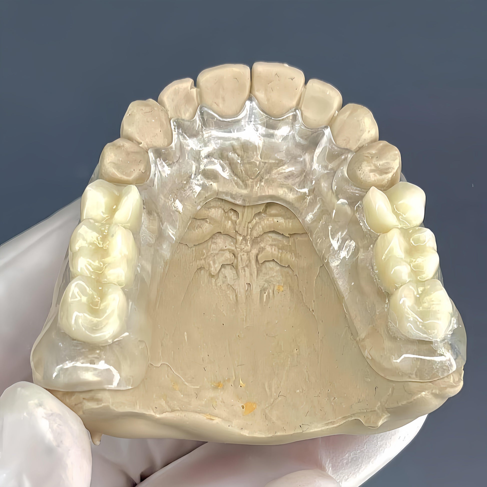 Acetal disc for flexible dental prosthetics and restorations