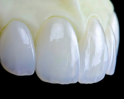 Lithium disilicate ingot designed for aesthetic dental restorations