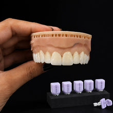 Finished dental prosthesis and restoration application example with Lithium Disilicate CAD/CAM Blocks