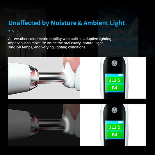 OnePro Dental Digital Shade-Matching Device
