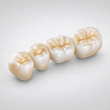 HT White zirconia dental bridge restoration for posterior CAD CAM applications
