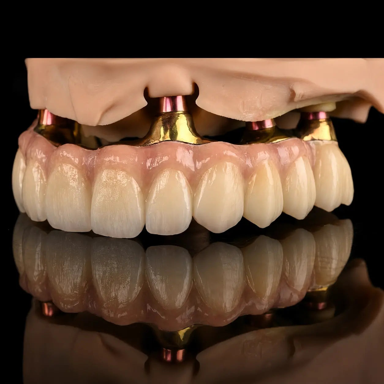 OnePro Dental SHT Preshaded zirconia full-arch implant restoration for dental CAD CAM labs