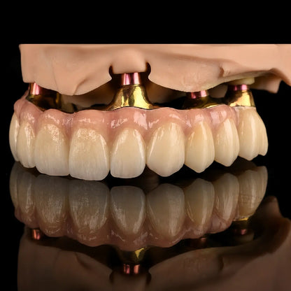 OnePro Dental SHT Preshaded zirconia full-arch implant restoration for dental CAD CAM labs
