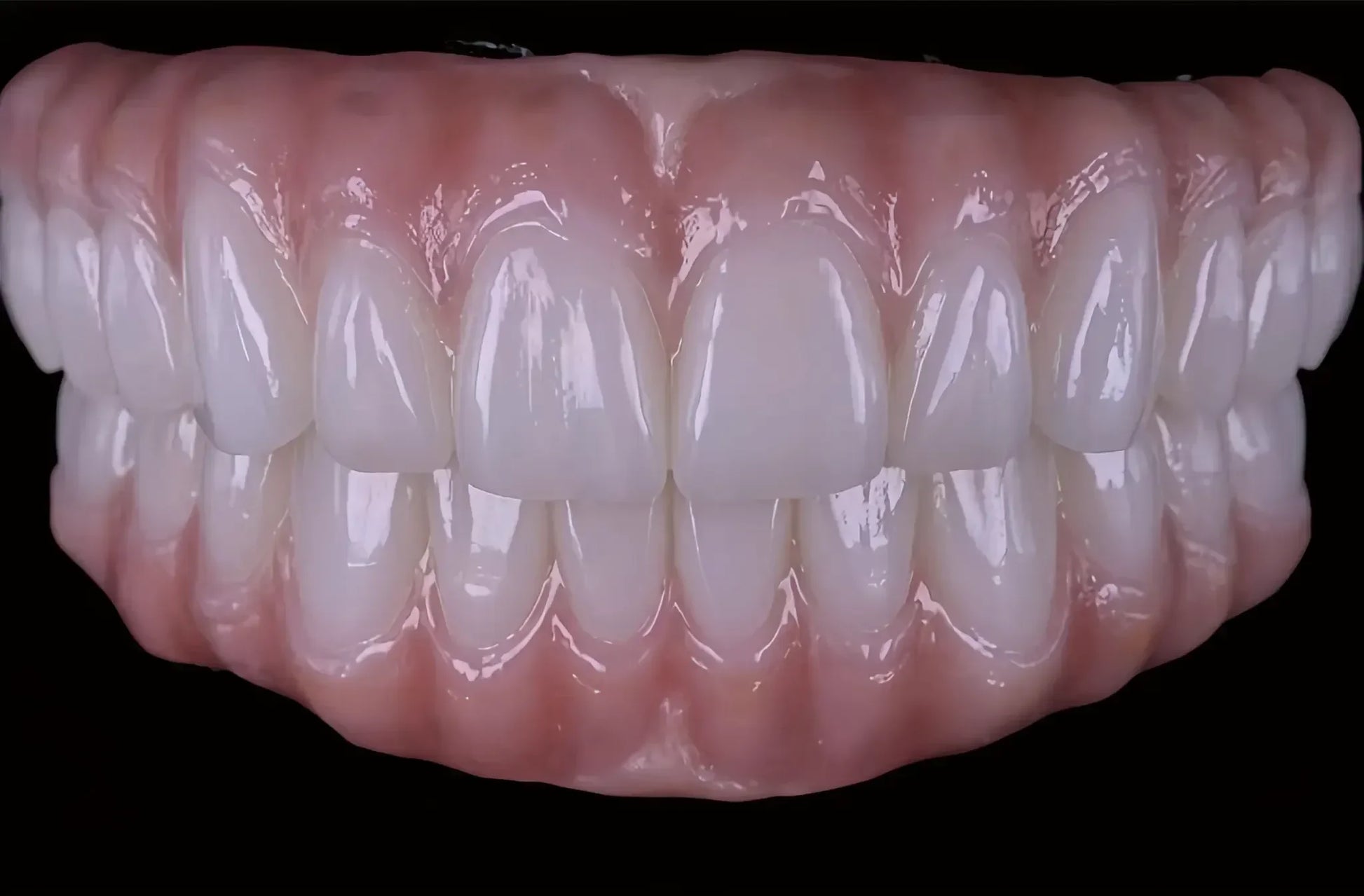 OnePro SHT White zirconia full-arch esthetic restoration with natural tooth translucency for dental CAD CAM 