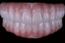 OnePro SHT White zirconia full-arch esthetic restoration with natural tooth translucency for dental CAD CAM 
