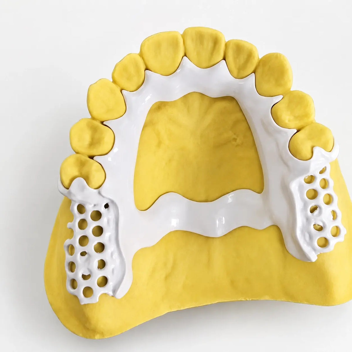 CAD/CAM milled white PEEK dental framework showing lightweight removable prosthetic restoration