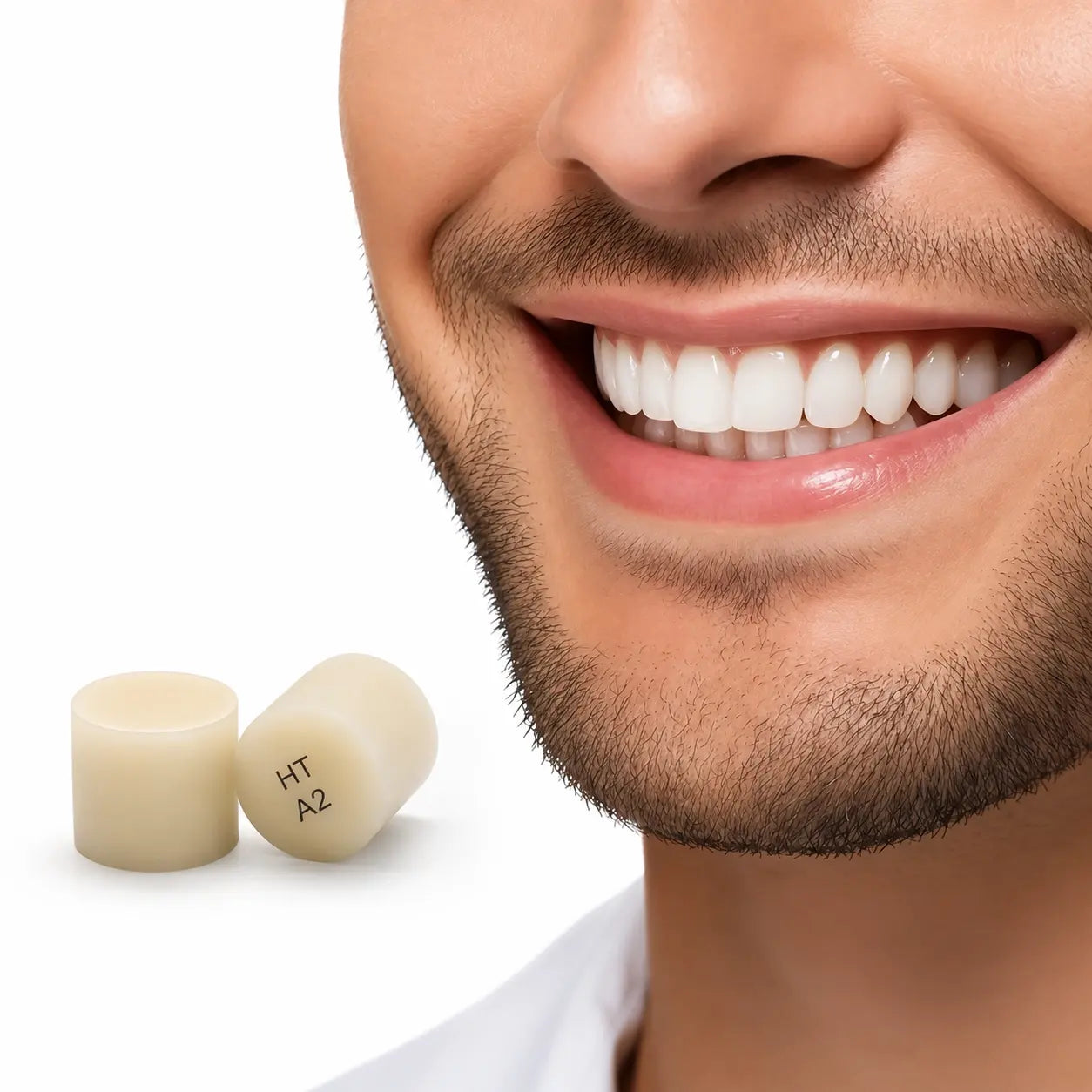 Natural smile restoration created with pressable lithium disilicate glass ceramic ingots