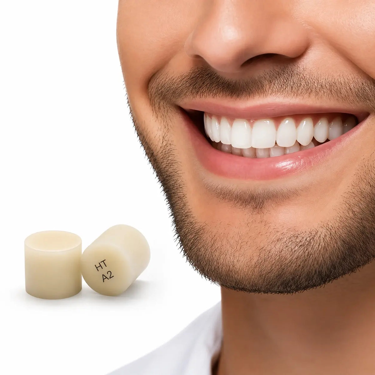 Natural smile restoration created with pressable lithium disilicate glass ceramic ingots
