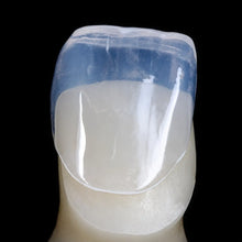 Single tooth restoration example made with pressable lithium disilicate glass ceramic ingot