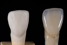 UT White zirconia crown comparison showing pre-finished and polished dental CAD CAM restoration for dental labs