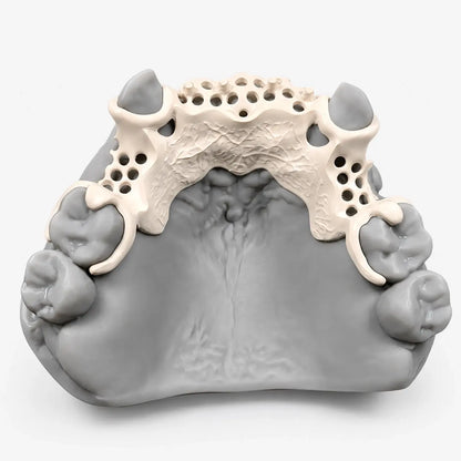CAD/CAM milled White PEEK dental framework for digital denture applications