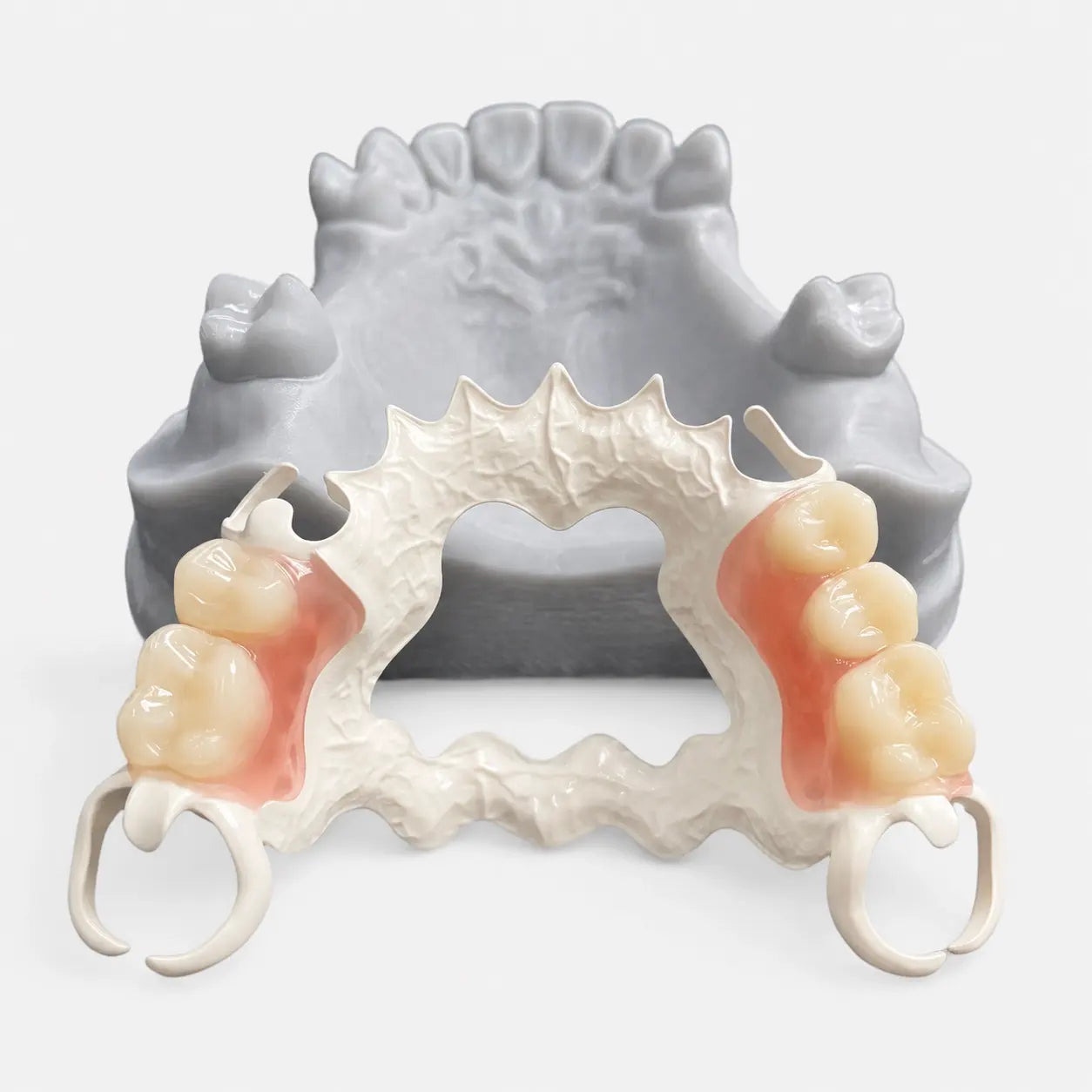 White PEEK Disc processed into lightweight removable dental prosthesis framework