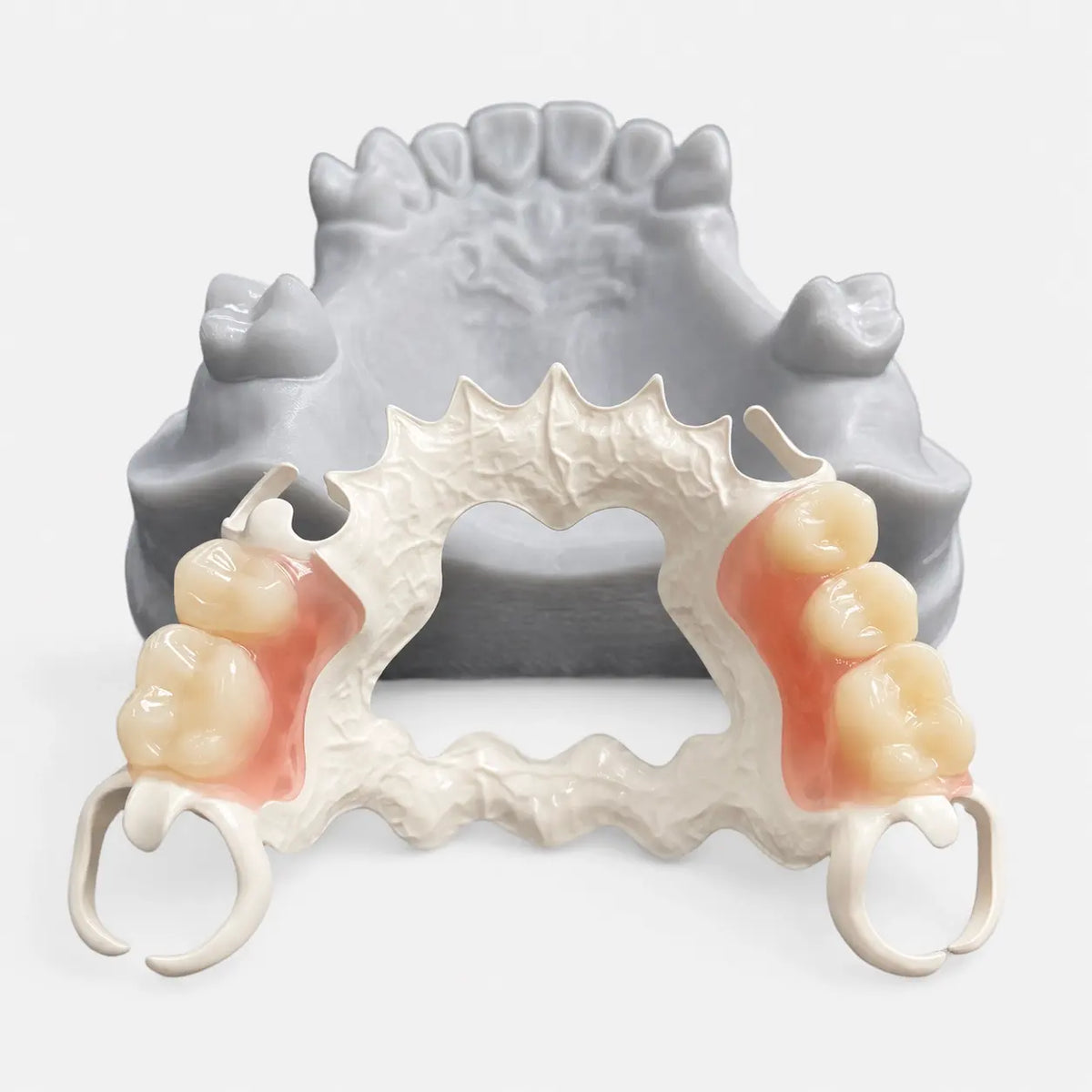 White PEEK Disc processed into lightweight removable dental prosthesis framework